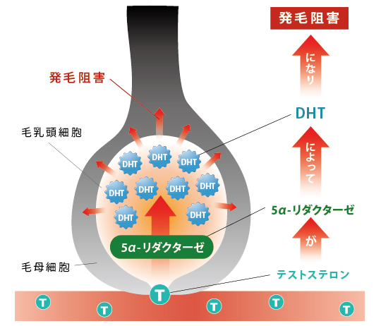 AGAが発症する仕組み