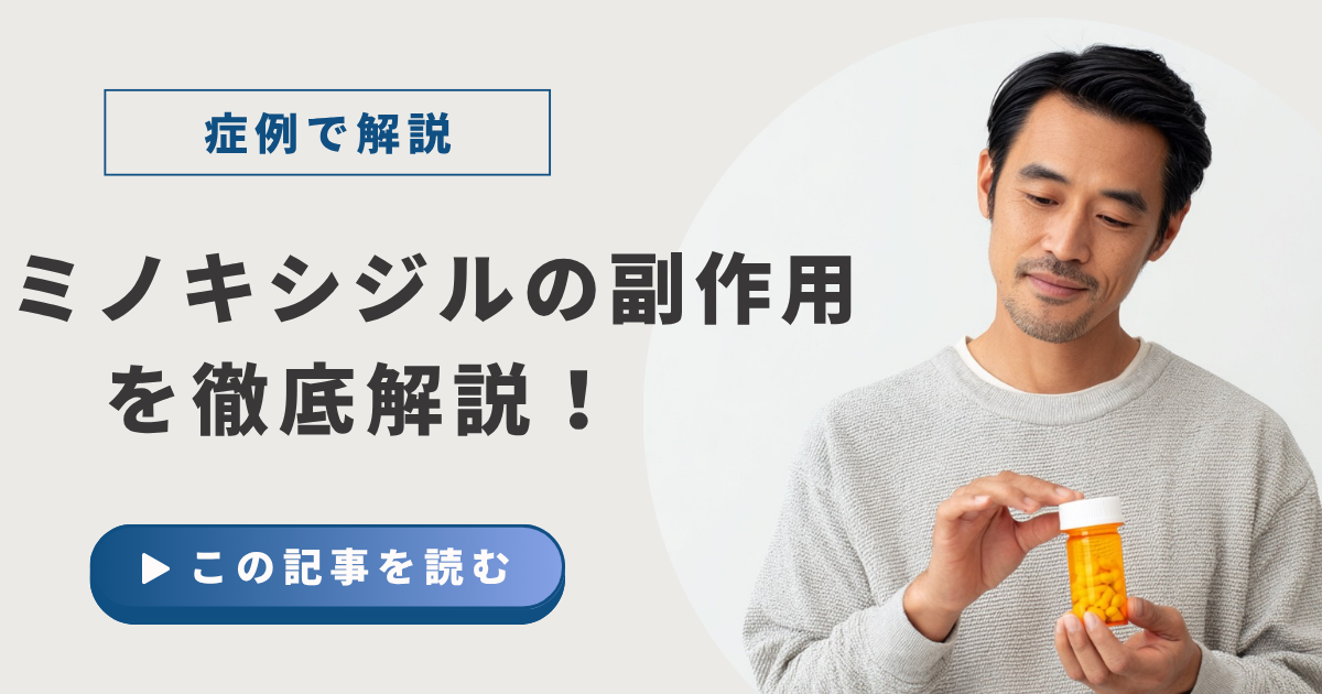 ミノキシジル副作用の症例アイキャッチ