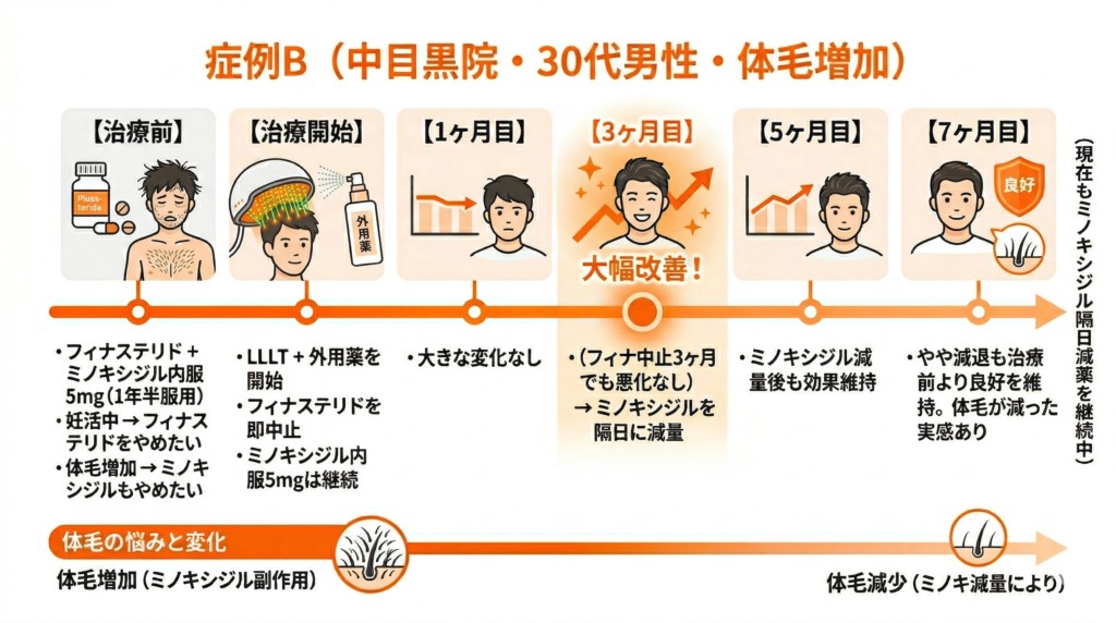中目黒院30代男性ミノキシジルをやめた経過図