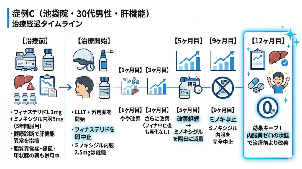 症例C池袋院30代男性ミノキシジルをやめた経過図