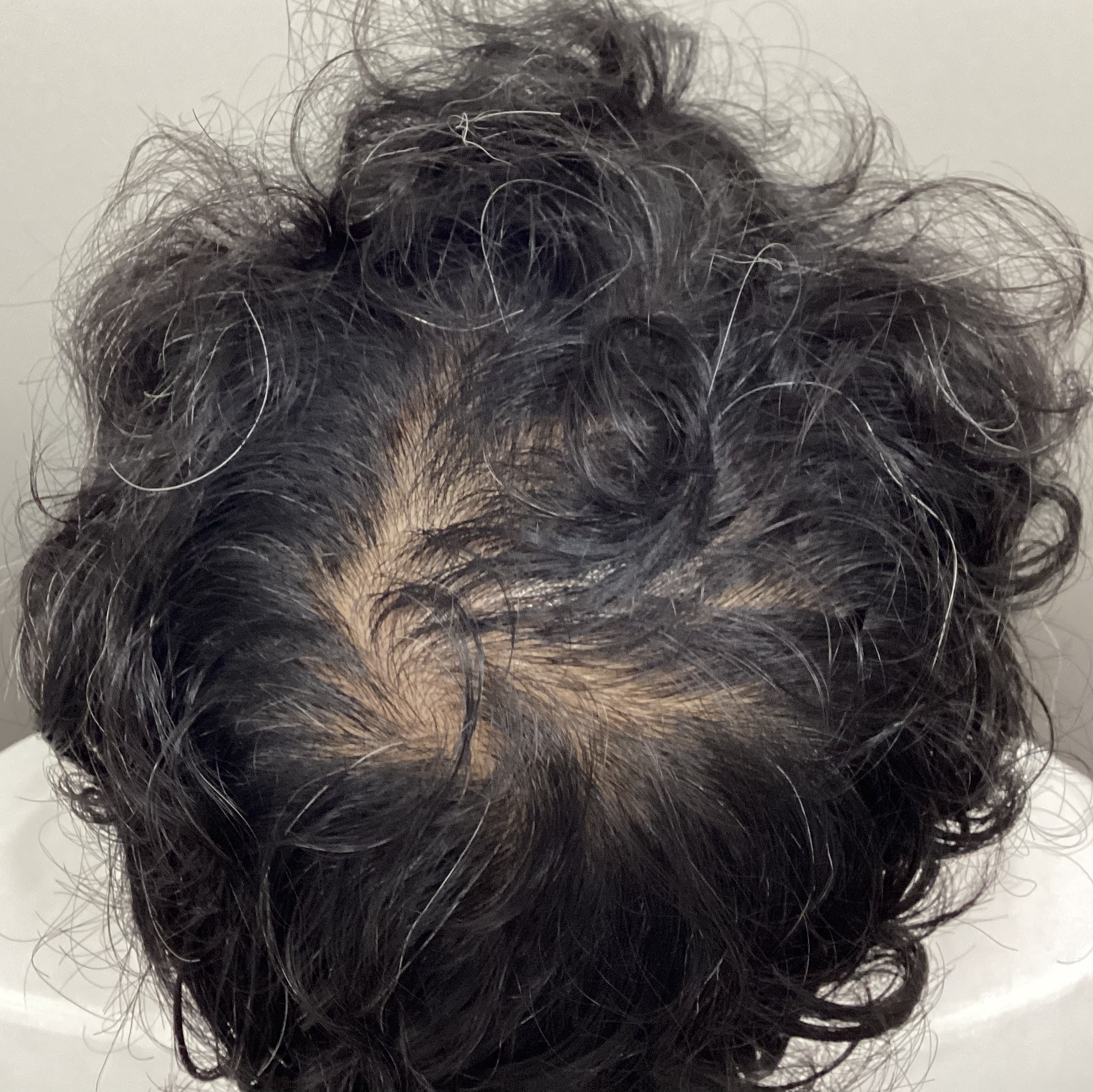 症例C 治療前の状態