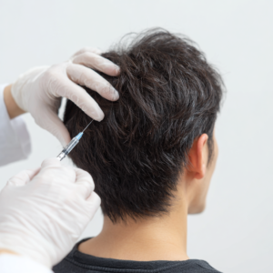 injecting_with_a_syringe_on_the_vertex_of_the_head