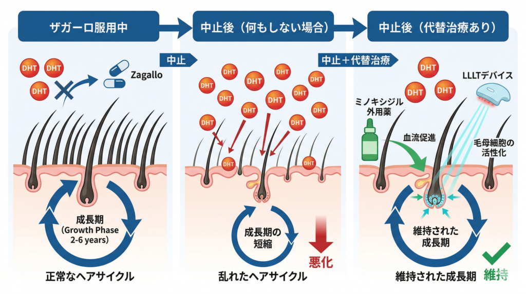 デュタステリドやめた時の変化のイラスト