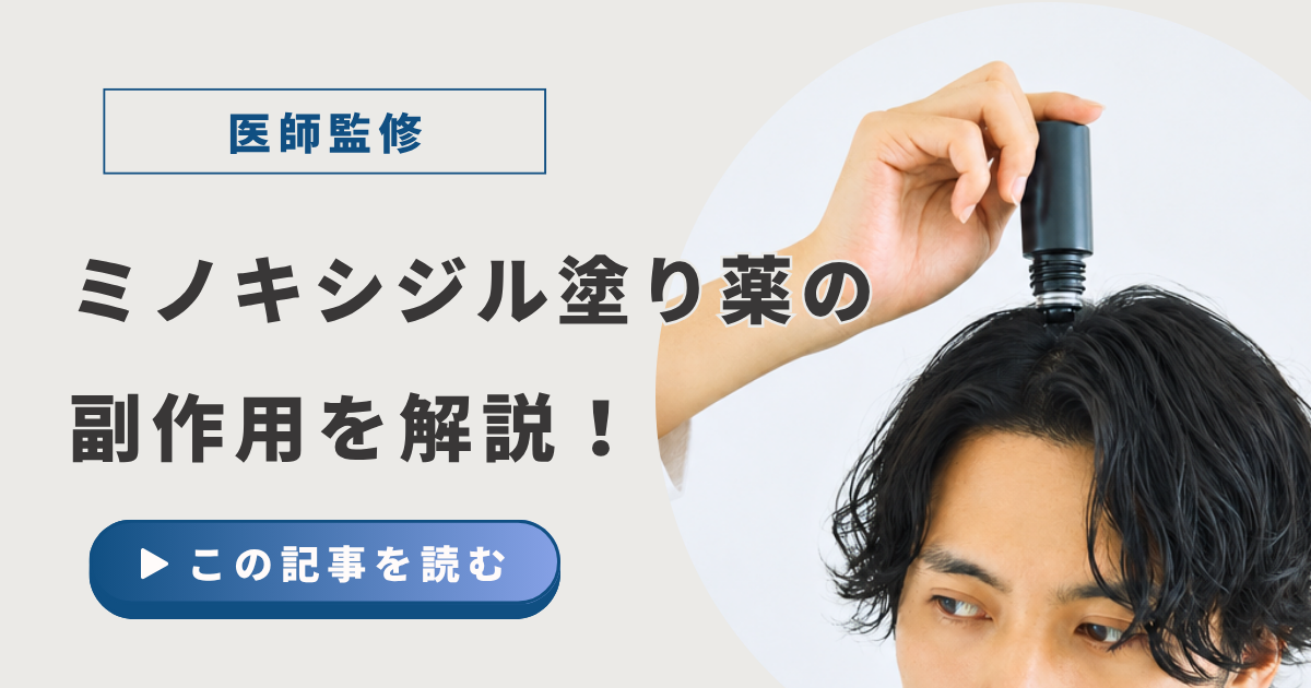 ミノキシジル塗り薬の副作用を解説！