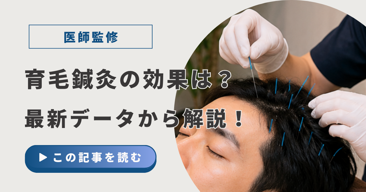 育毛鍼灸アイキャッチ