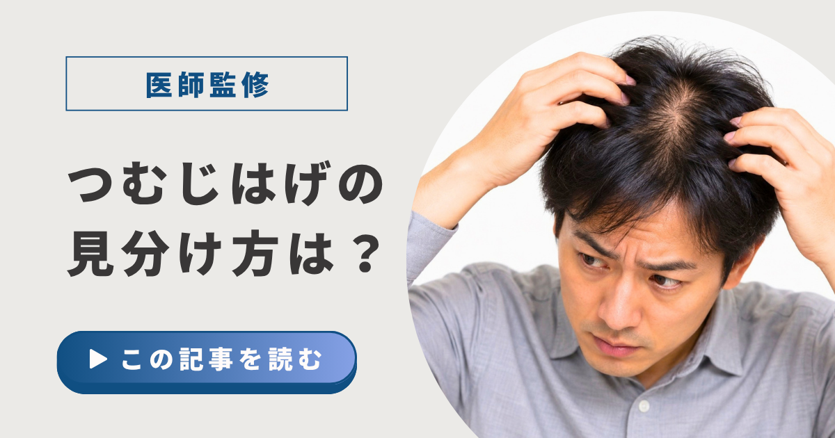 つむじはげの見分け方アイキャッチ